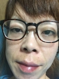 お肌の