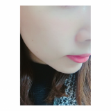 「ほうれい線にきいた‼︎」の画像（3枚目）