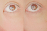 「見てみて！目頭&darr;のたるみの違い」の画像（1枚目）