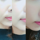 「ほうれい線に嬉しい変化」の画像（2枚目）