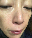 「薬用美白オールインワンジェル☆お試し！」の画像（2枚目）