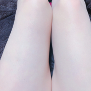 「上が浮腫んでる時で」★パンパンでつらい・・・むくみにお悩みの方大募集★の投稿画像