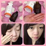 大人ニキビやにきびの跡に悩む方にオススメの『シーバムコントロールVCローションII 100mL』です♡.驚くのは浸透力とニキビにすごく効くこと。原因の分からないニキビも、このローションを付けて&hellip;のInstagram画像