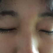 「薬を使いましたが…」【まつげ専用サプリメント＆美容液で】まつ育モニター募集☆15名様の投稿画像