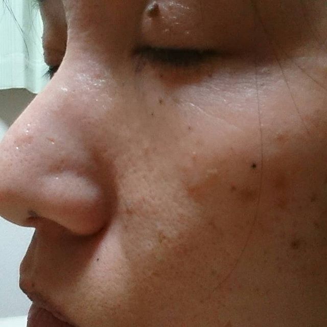 口コミ投稿：１枚目は使用前。どんな感じかなとドキドキしながら…😊２枚目はその日の使用後。まだ…