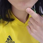 コンシーラーはじめて使ってみました🔰ちょうど揚げ物つくったらあごにニキビができて😭💦pic1試してみました👍**コンシーラーを肌にのせてpic3**指でぽんぽんぼかしま&hellip;のInstagram画像