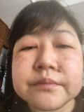 口臭ゼロ
