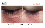 「右目が明らかに！」の画像（1枚目）