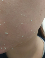 口コミ：むき肌つるん ぽろぽろとれる杏ジェルの画像（6枚目）