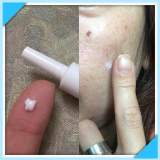 「 KISO  ハイドロクリーム SHQ10(安定型ハイドロキノン10％配合)」の画像