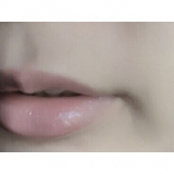 「毛が薄くなってびっくりしました( &deg;_&deg; )」の画像（2枚目）