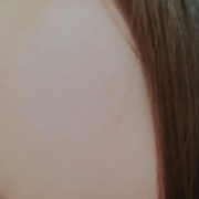 「頬の美容」肌自慢コンテスト開催！★VCローションお試しサイズをプレゼント♪20180615の投稿画像