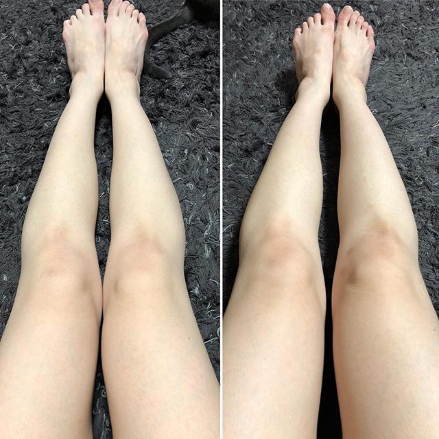 口コミ投稿：一ヶ月美脚チャレンジ終了👣毎日脚マッサージを続けて良かったことは・脚の疲れが翌日…