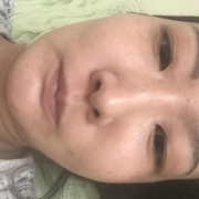 「かお」【顔出しOK】【本品】大人気！新VCローションの長期1ヶ月モニター♪180727の投稿画像