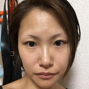 「加工なし」【顔出しOK】【本品】大人気！新VCローションの長期1ヶ月モニター♪180727の投稿画像