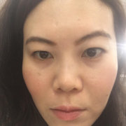 「右頬のシミっぽくなっている部分です」【顔出しOK】【本品】大人気！新VCローションの長期1ヶ月モニター♪180727の投稿画像