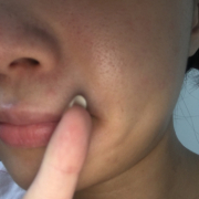 「顔出しＯＫです！」【顔出しOK】【本品】大人気！新VCローションの長期1ヶ月モニター♪180727の投稿画像