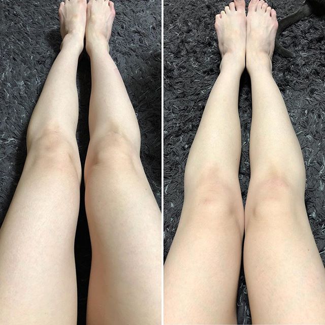 口コミ投稿：一ヶ月美脚チャレンジを終えてからも﻿頂いたトラベル用ジェルが残っていたので﻿脚マ…