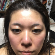 「なし」【渋谷で体験！】テノール治療＆ドクターズコスメ「オムニキュア」PINK現品の投稿画像