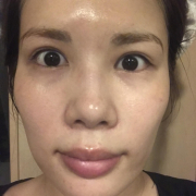 「年齢的に」【渋谷で体験！】テノール治療＆ドクターズコスメ「オムニキュア」PINK現品の投稿画像