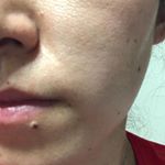 33歳 混合肌肌の調子が悪すぎる！毛穴の開きと内側の乾燥を改善してキレイなファンデーションなしもしくは薄い化粧で済む肌になりたい！！ライスフォースを使って綺麗な肌を実感してみたい！#ライスフォ&hellip;のInstagram画像