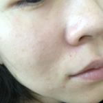 目指せたるみ毛穴撃退！！#加工なし#ライスフォース #riceforce #monipla #riceforceacpoless_fanのInstagram画像