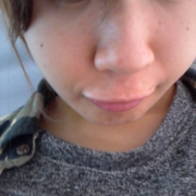 「日焼け肌改善」【キレイと元気をサポート】すっぽん黒酢酵素　モニター募集♪ の投稿画像