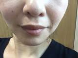 口コミ：口元美人の画像（5枚目）