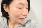「使用前&rarr;3日目&rarr;10日目です」の画像（1枚目）