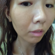 「よろしくお願いします」ニキビが出来ても慌てない！【アッカノン】 の「うるおいケア」をお試しあれ♪の投稿画像