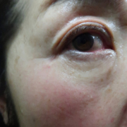 「とにかく赤い」「目元写真」のご投稿でぷるぷるコラーゲンゼリープレゼント♪の投稿画像