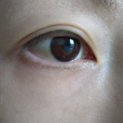 「琉球すっぽんコラーゲンゼリーで乾燥ケアしたいです」「目元写真」のご投稿でぷるぷるコラーゲンゼリープレゼント♪の投稿画像