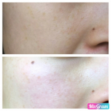 「キメが整う」の画像（1枚目）