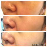 「お肌がキレイに♡」の画像（1枚目）