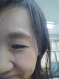 目尻の小じわ