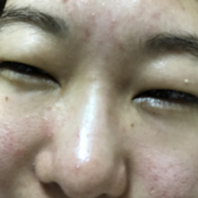 「小じわ」★塗るだけフェイスマスク★　薬用リペアベールエッセンス　長期モニター募集！！の投稿画像