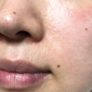 「口もと」★塗るだけフェイスマスク★　薬用リペアベールエッセンス　長期モニター募集！！の投稿画像