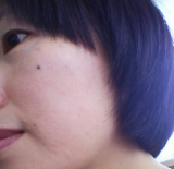 「シミもシワも。年齢肌を改善させたい。」の画像（1枚目）