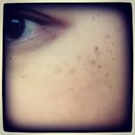 #kiso #基礎化粧品研究所 #美白 #ハイドロクリーム #ハイドロキノン #monipla #kisocare_fanシミと戦う戦力が欲しい😨😰😱😥😵💦のInstagram画像