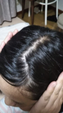 「頭頂部、分け目」の画像（3枚目）