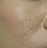 「脂漏性皮膚炎用」の画像（1枚目）