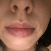 「残念な肌」10名様募集！！たるみによるほうれい線ケア美容液が試せるチャンス【434】の投稿画像