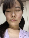 「たるみ」の画像（1枚目）