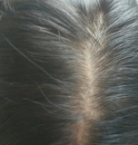 「薄毛」の画像（2枚目）