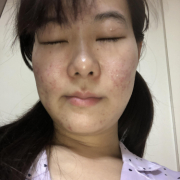 「たるみ」10名様募集！！たるみによるほうれい線ケア美容液が試せるチャンス【434】の投稿画像