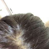 「頭頂部」の画像（1枚目）