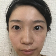 「モニター用スッピン写真」＜商品PRモデルとして活躍！＞肌悩みのある方で撮影に参加頂ける方大募集！！の投稿画像