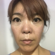 「肌の状態」＜商品PRモデルとして活躍！＞肌悩みのある方で撮影に参加頂ける方大募集！！の投稿画像