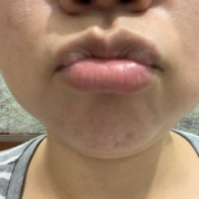 「すぐに乾燥する唇」SASS.シュガースクラバーム　モニター 5名募集！の投稿画像