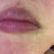 「化粧水よりリップクリームが必要なんです涙 無いと大変な事に！」SASS.シュガースクラバーム　モニター 5名募集！の投稿画像